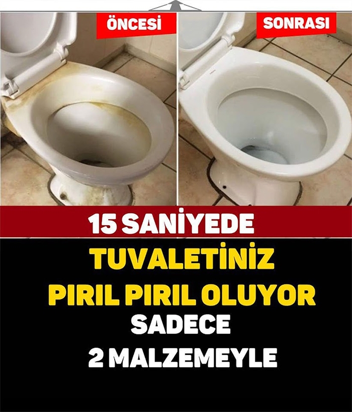 TUVALETİNİZ PIRIL PIRIL OLSUN galerisi resim 1