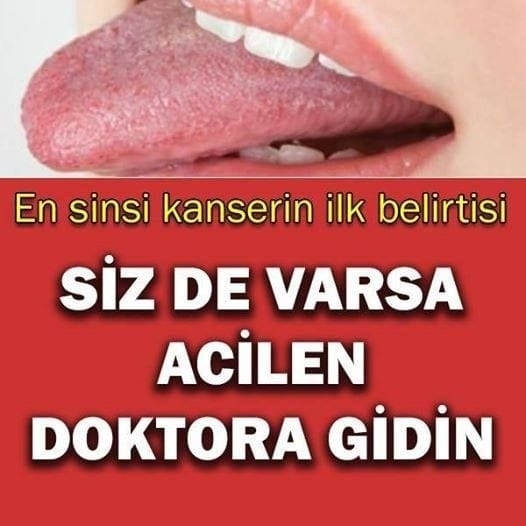 Bu Belirtiler Varsa Durmayın galerisi resim 1