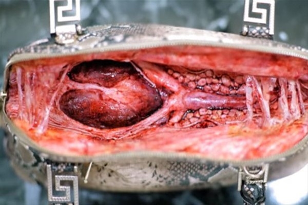 Mağazada Beğendiği Çantayı Açınca…Dehşete Düştü! galerisi resim 2