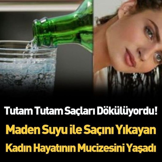 İşte saçlarının öncesi ve sonrası galerisi resim 1