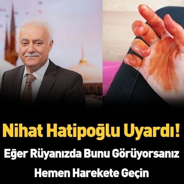 Uykudan uyandı galerisi resim 1