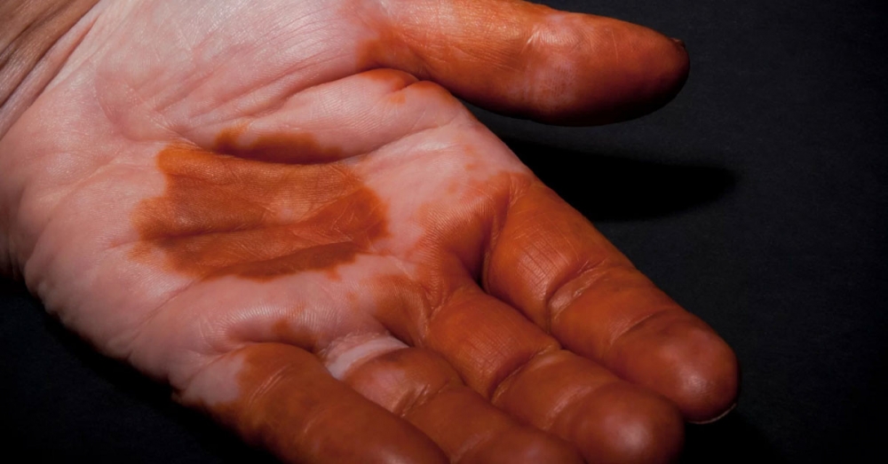 Uykudan uyandı galerisi resim 7