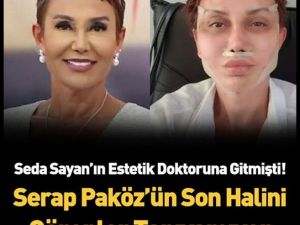Seda Sayan’ın estetik doktoruna giden Serap Paköz değişimiyle herkesi şa