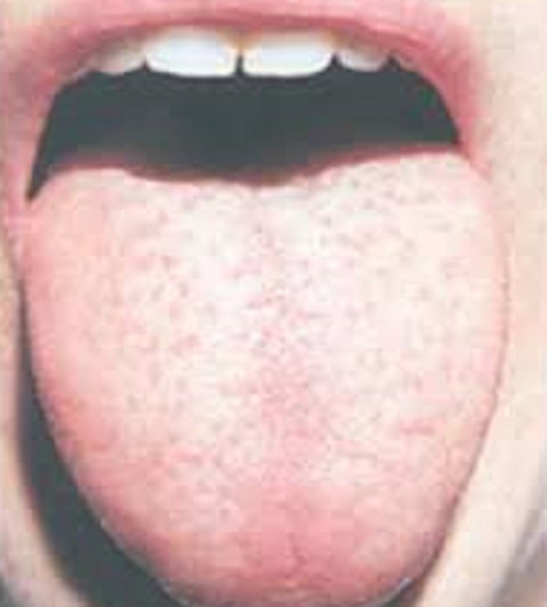 Dilinizin Hastalıkların Habercisi Olduğunu Biliyor Muydunuz? galerisi resim 8