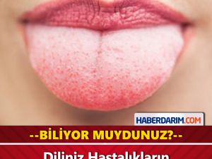 Dilinizin Hastalıkların Habercisi Olduğunu Biliyor Muydunuz?