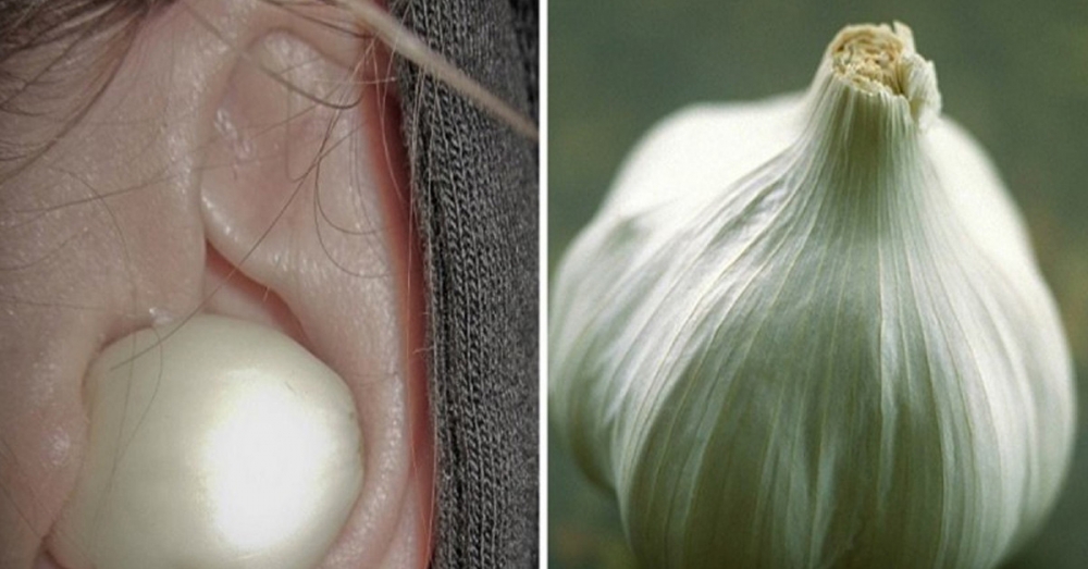 Sarımsak kullanmanın 5 alternatif yolu galerisi resim 7