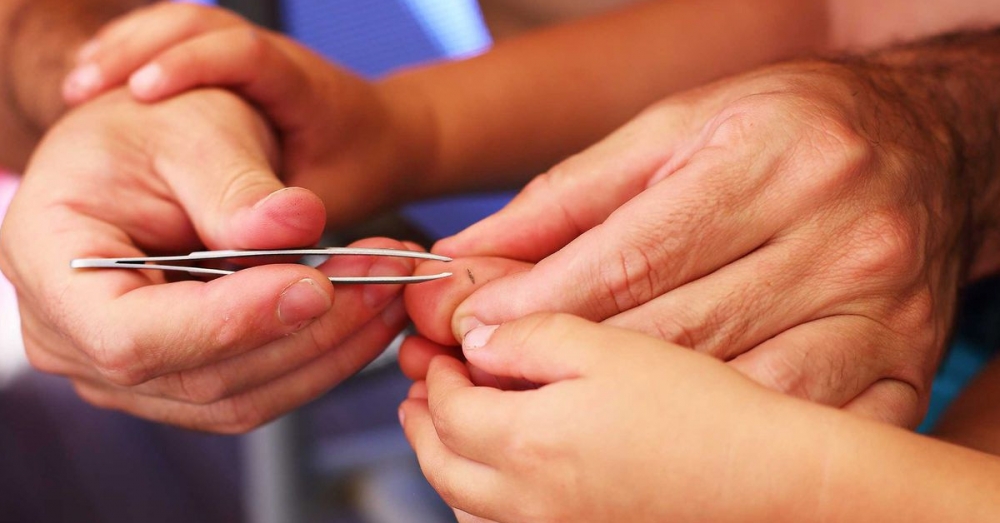 Sarımsak kullanmanın 5 alternatif yolu galerisi resim 9