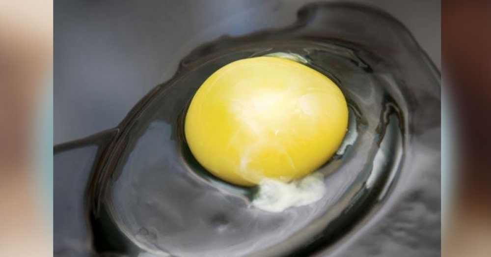 Yumurtanın içindeki ipliğe benzer beyaz şey nedir? galerisi resim 3