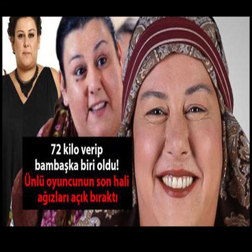 72 kilo verip bambaşka biri oldu! galerisi resim 1