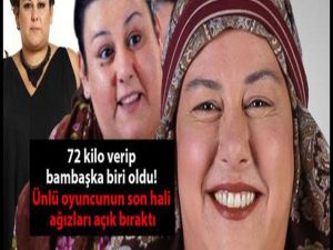 72 kilo verip bambaşka biri oldu!