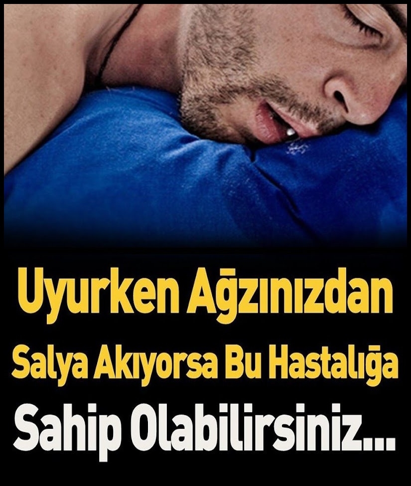 Ağzınızdan Salya Akıyorsa galerisi resim 1