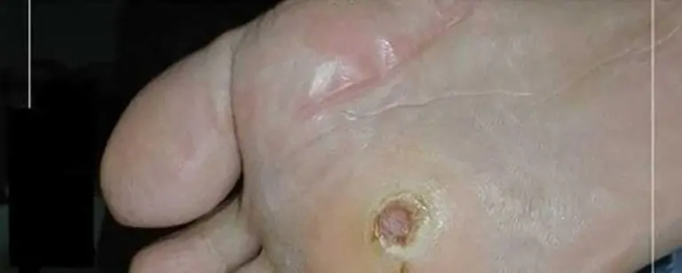 Kanserin  1 belirtisi  daha ortaya çıktı. galerisi resim 3