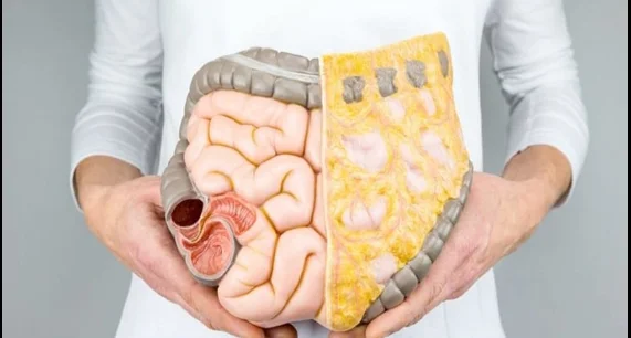 Bağırsak K’anserinin Belirtileri Nelerdir? Erken Teşhis Hayat Kurtarır galerisi resim 2