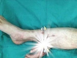 Çin'de Yapılan Çin İşi Ameliyat Yok Artık Dedirtti. İşte ayrıntılar