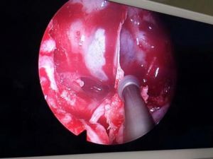 Tuvalete sık gitme hissi ciddi bir sorunu ortaya çıkardı