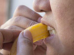 Dişleri beyazlatmanın 5 yolu
