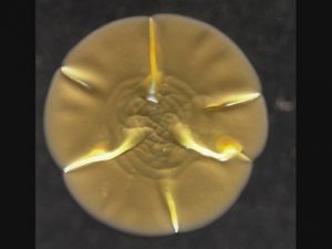 Bu Bakteriler Cep Telefonunda Yaşıyorlar