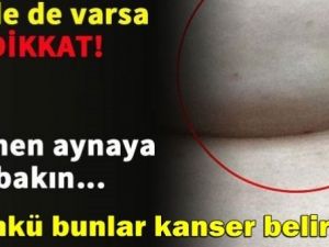 Kanser olduğunu internetten öğrendi!
