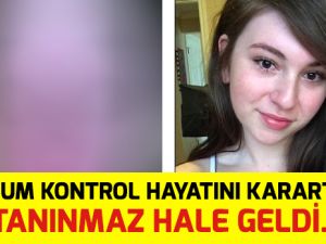 DOĞUM KONTROL HAPI HAYATINI KARARTTI! TANINMAZ HALE GELDİ! AMAN DİKKAT!