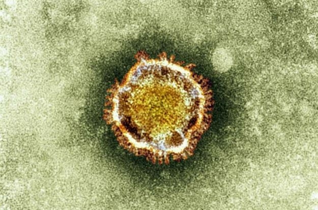 10 Soruda MERS Virüsü! galerisi resim 5
