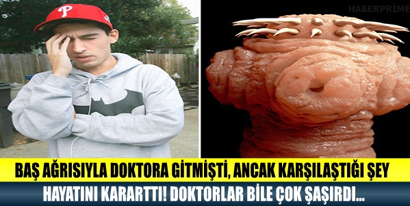 BAŞ AĞRISIYLA DOKTORA GİTMİŞTİ, ANCAK KARŞILAŞTIĞI ŞEY HAYATINI KARARTTI galerisi resim 1