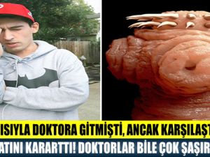 BAŞ AĞRISIYLA DOKTORA GİTMİŞTİ, ANCAK KARŞILAŞTIĞI ŞEY HAYATINI KARARTTI