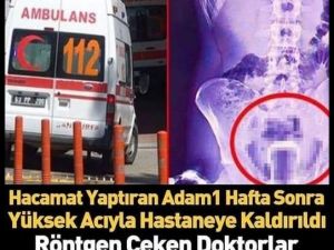 Hacamat Yaptıran Adam