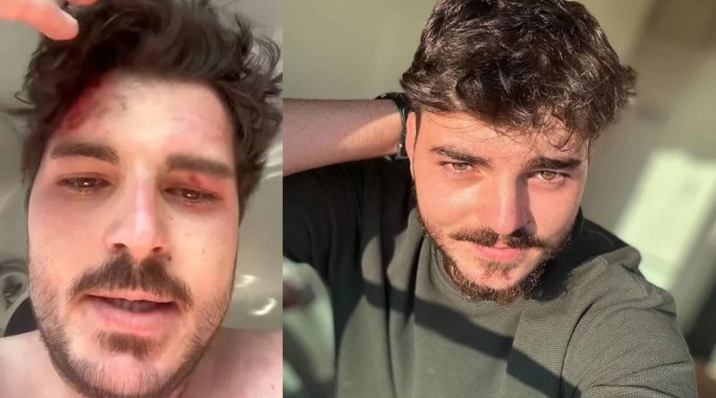 Dizi oyuncusu ne hale geldi galerisi resim 1