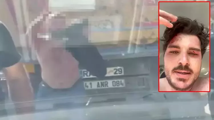 Dizi oyuncusu ne hale geldi galerisi resim 3