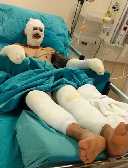 Son hali yürek yaktı galerisi resim 2