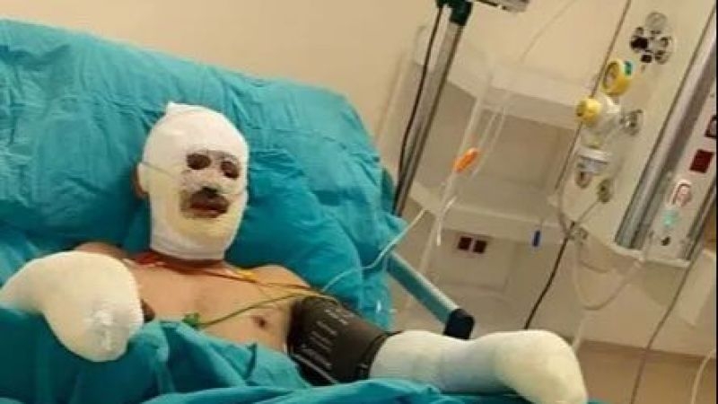 Son hali yürek yaktı galerisi resim 3