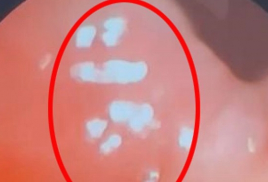 Öksürük şikayetiyle hastaneye gitti, galerisi resim 3