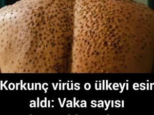 Korkunç virüs o ülkeyi esir aldı