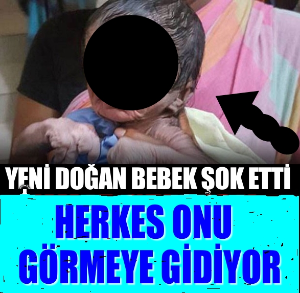 Bu bebek bugün Dünya'ya geldi! . Gören gözlerine inanamıyor :( galerisi resim 1