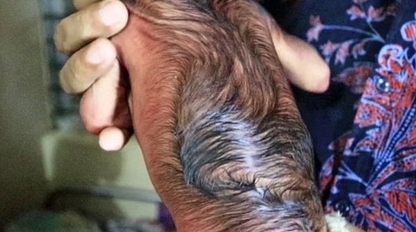 Bu bebek bugün Dünya'ya geldi! . Gören gözlerine inanamıyor :( galerisi resim 3