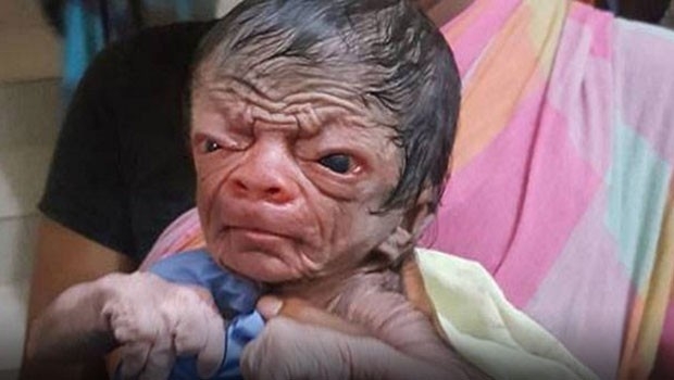 Bu bebek bugün Dünya'ya geldi! . Gören gözlerine inanamıyor :( galerisi resim 5