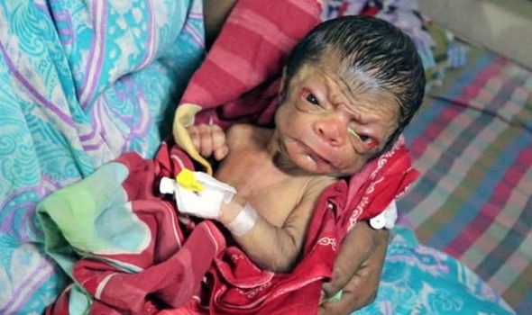 Bu bebek bugün Dünya'ya geldi! . Gören gözlerine inanamıyor :( galerisi resim 9