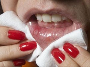 Ağzınızda bu yaralardan çıkıyorsa dikkat..