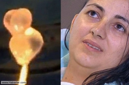 Sürekli başı Ağrıyordu Baş ağrısının sebebi galerisi resim 3