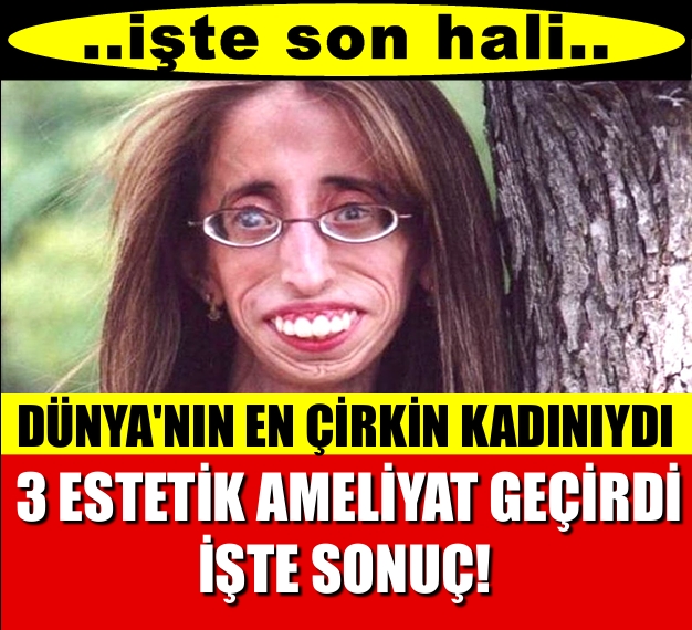 Ameliyat üstüne ameliyat oldu... şimdi tek hayali var aşık olmak . galerisi resim 1