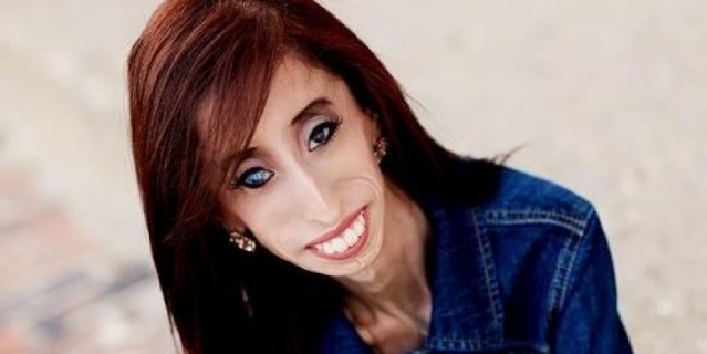 Ameliyat üstüne ameliyat oldu... şimdi tek hayali var aşık olmak . galerisi resim 7