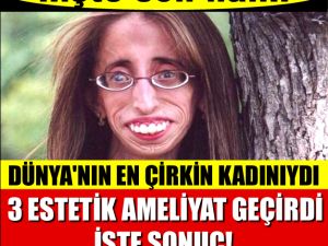 Ameliyat üstüne ameliyat oldu... şimdi tek hayali var aşık olmak .