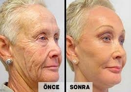 Her Sabah Yüzünüzü Bu 2 Malzemeli Karışımla Yıkayın galerisi resim 3