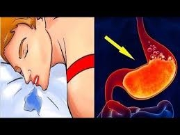 Uyurken ağzınız sulanıyorsa, galerisi resim 3