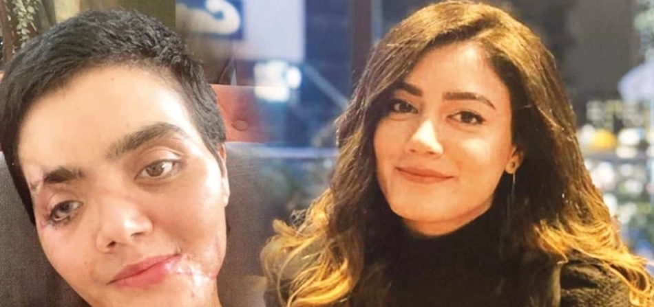 Henüz 25 yaşındaki Yaren Gürbüz’ün başına gelenler galerisi resim 3