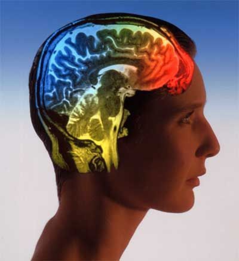 Beyninizi Nasıl Kullanıyorsunuz? TEST EDİN galerisi resim 12