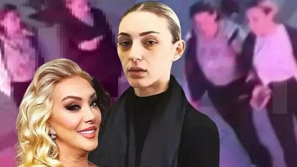 Güllü'nün nasıl 'düştüğü' raporda ortaya çıktı! galerisi resim 3