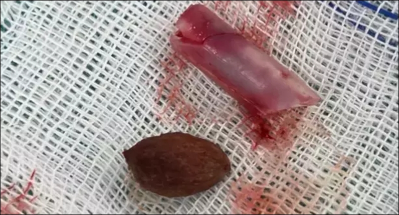 Burnundan çıkanları görenler yok artık diyor galerisi resim 3