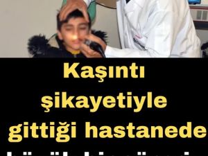 Burnundan çıkanları görenler yok artık diyor