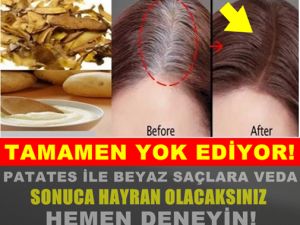 Patates Kabuğu İle Beyaz Saçları Kapatın...işte o mucize yöntem